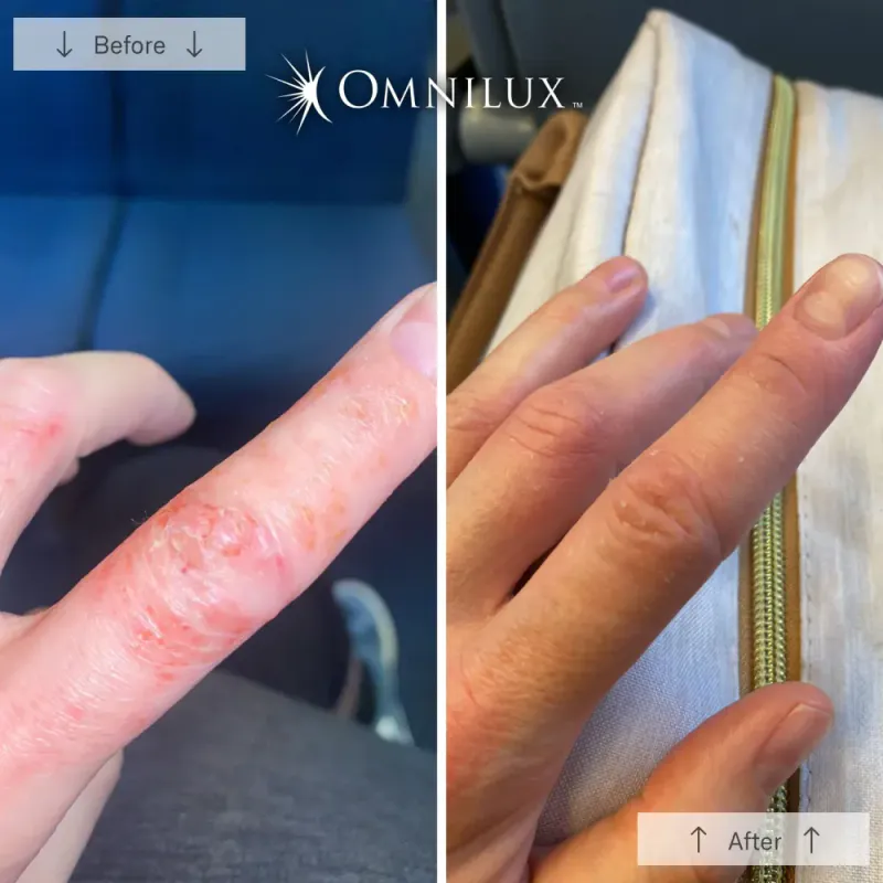 Omnilux Contour Glove