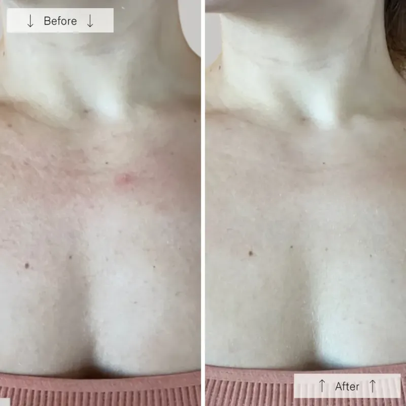 OMNILUX CONTOUR NECK & DÈCOLLETÈ 
